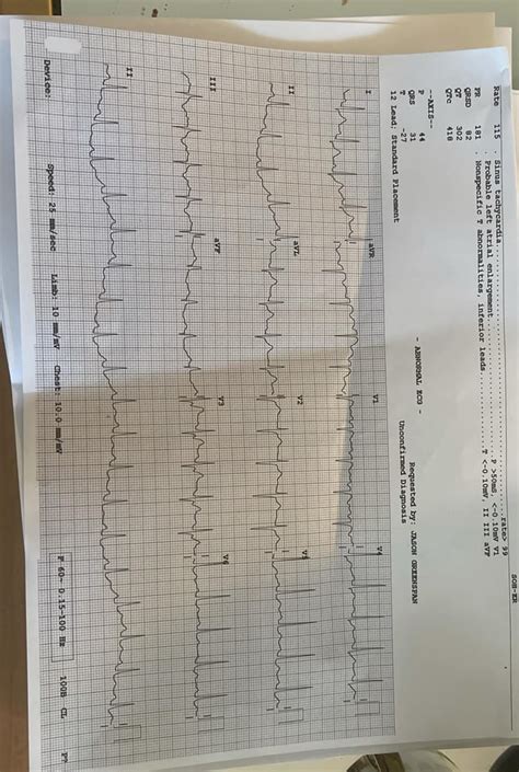 cannot rule out anteroseptal infarct.